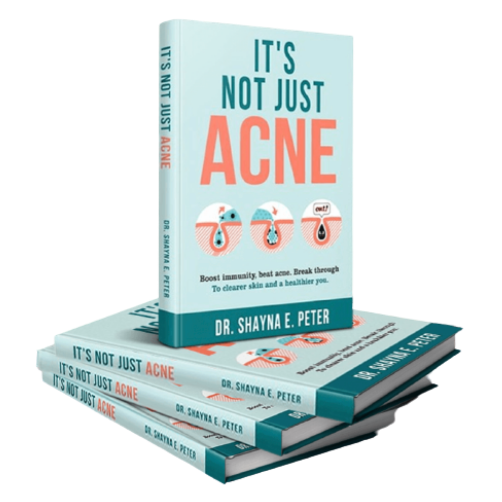 It's Not Just Acne